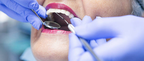Best Emergency Gum Treatment in Preston, TX